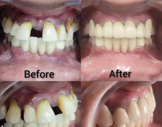 Visit Shantilila Dental Hospital for best dental checkup services