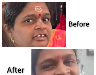 Visit Shantilila Dental Hospital for best dental checkup services